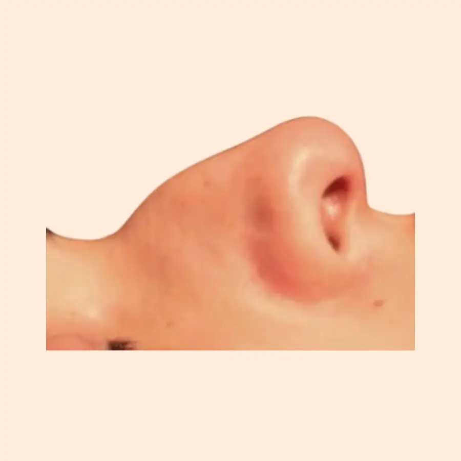 قبل