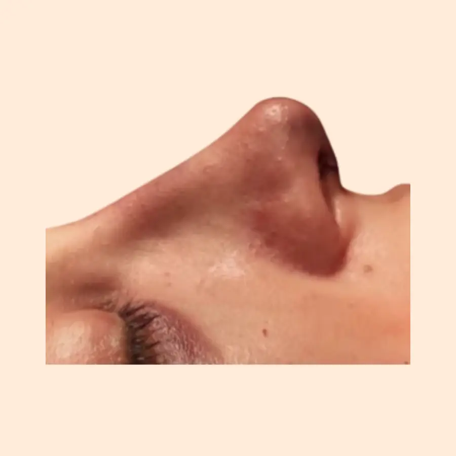 بعد