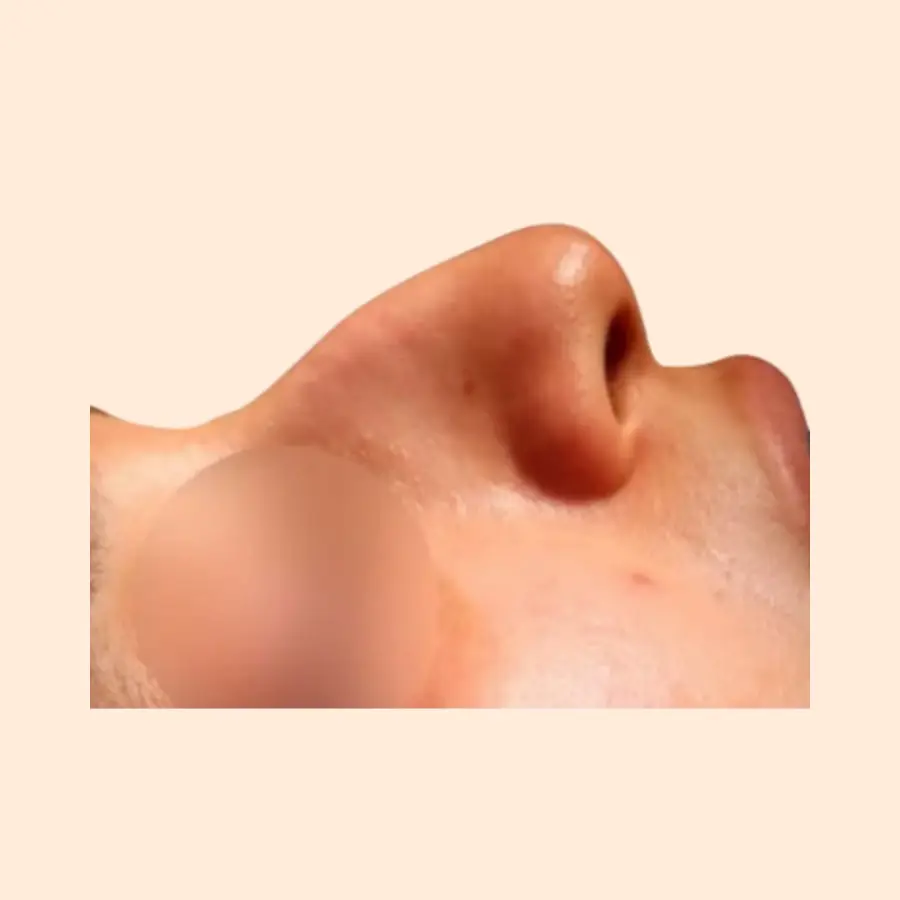 قبل