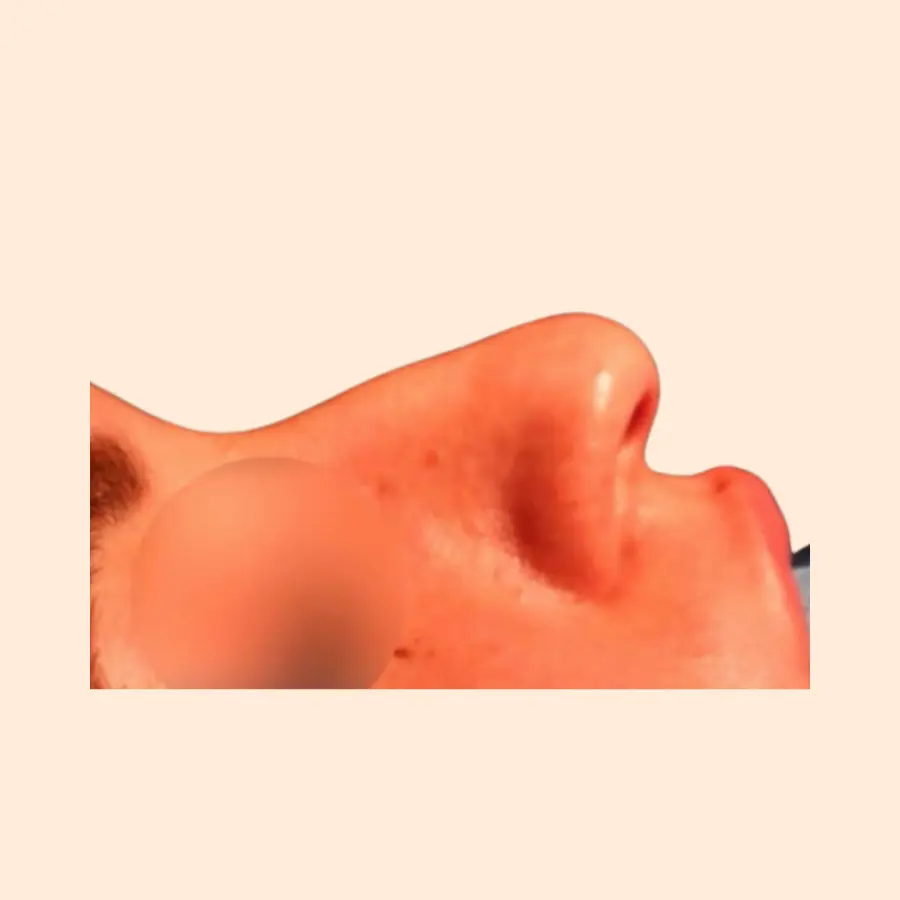 قبل