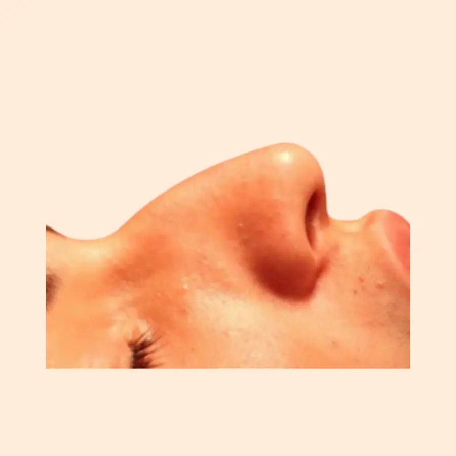 قبل