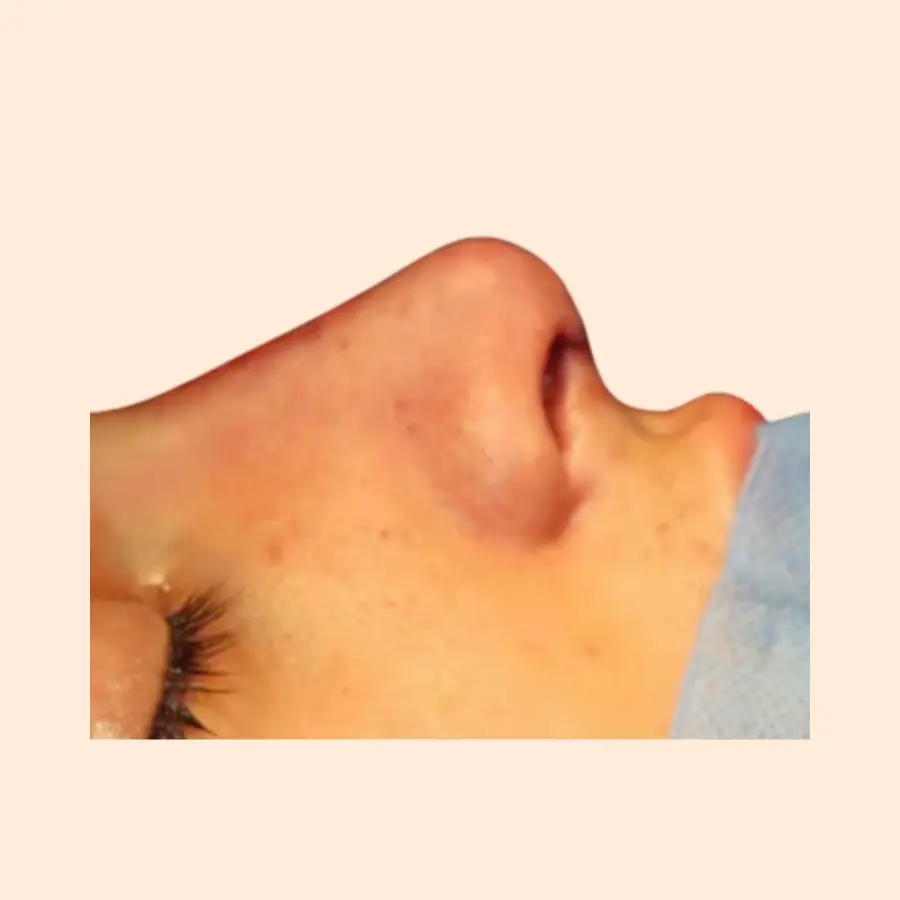 بعد