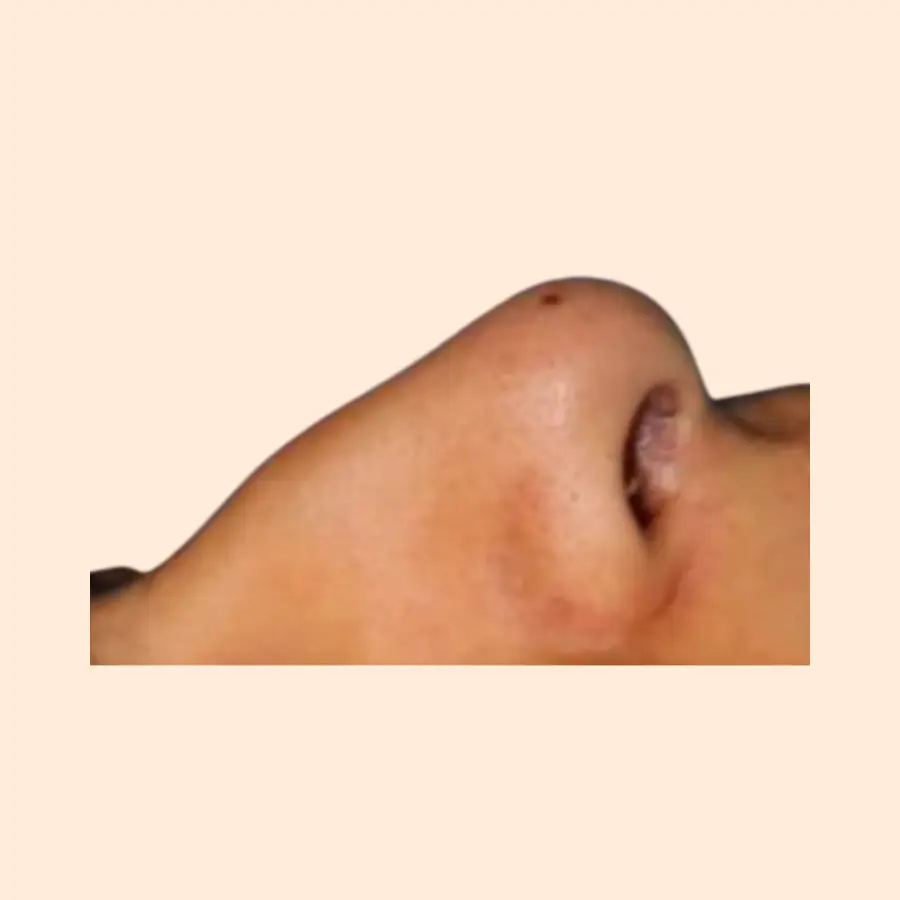 قبل
