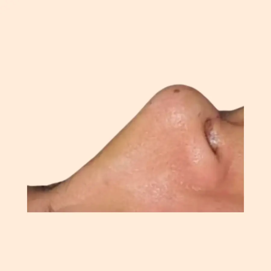 بعد