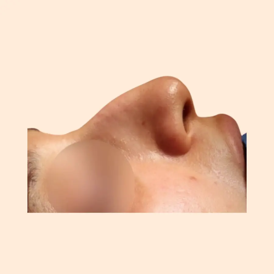 قبل