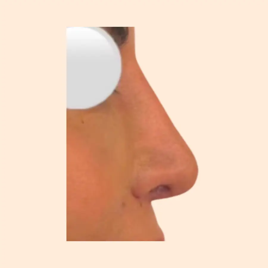 بعد