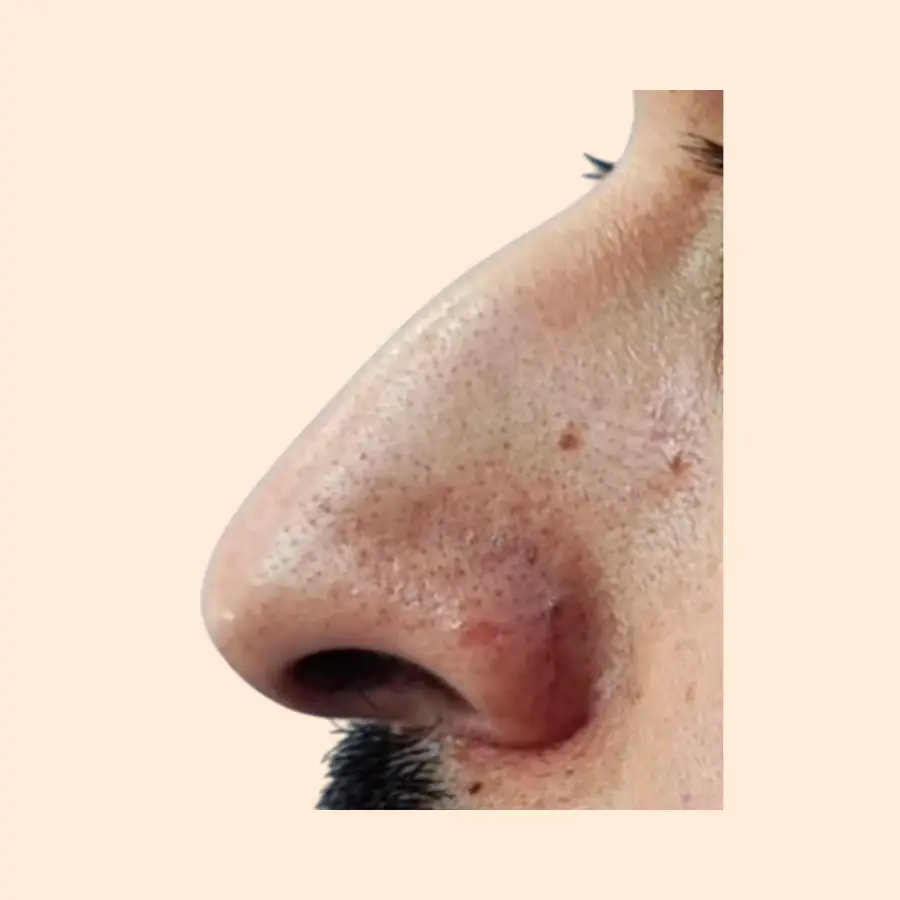 قبل