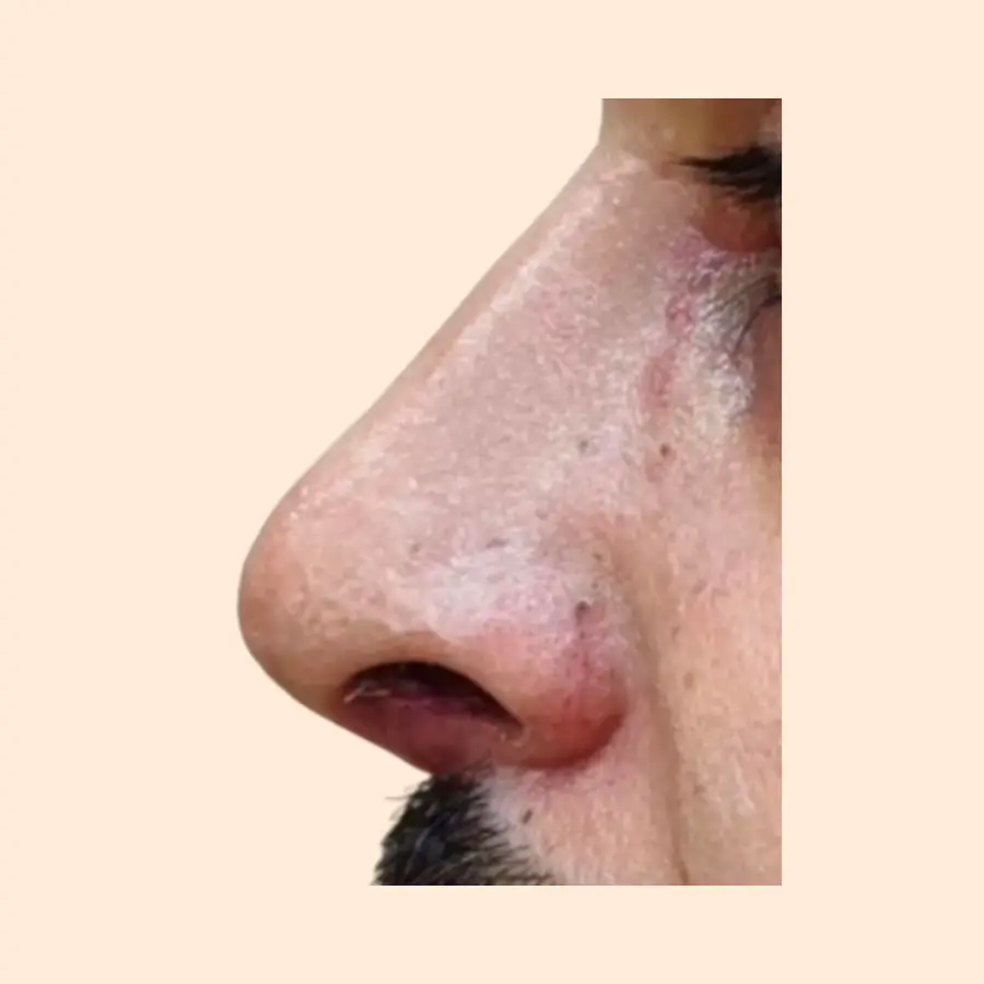 بعد
