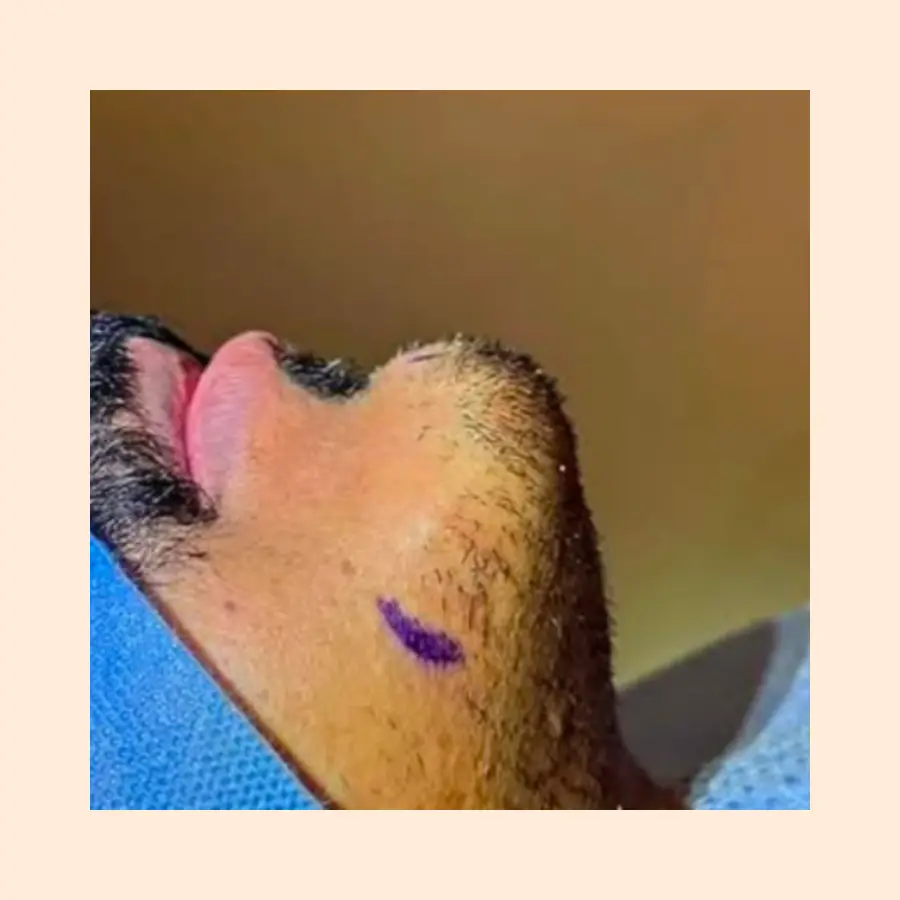 بعد