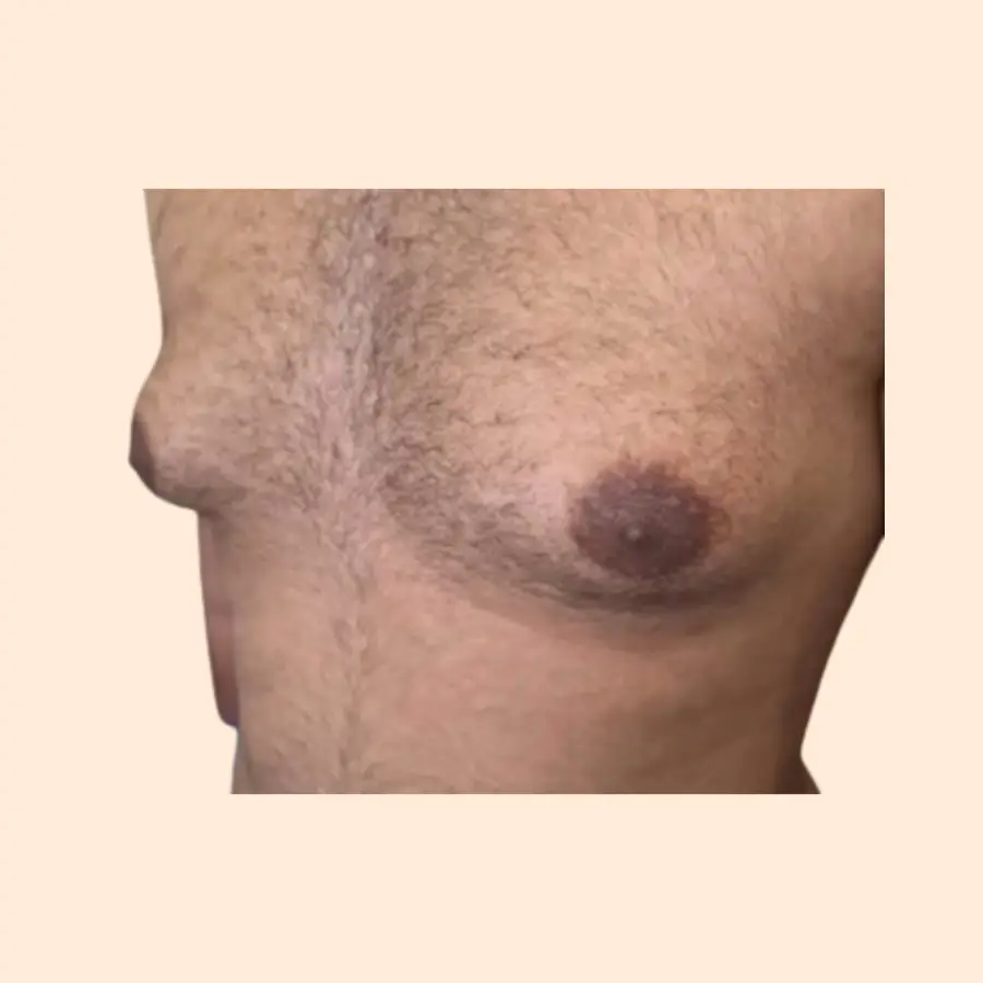 قبل