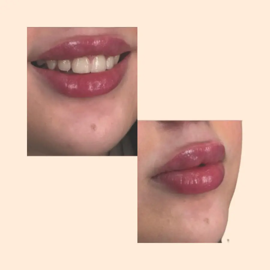 بعد