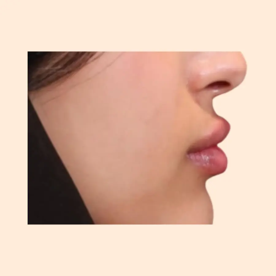 بعد